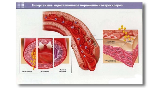 Аппарат измерения сахара холестерина крови